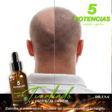 5 potencia caida de cabello